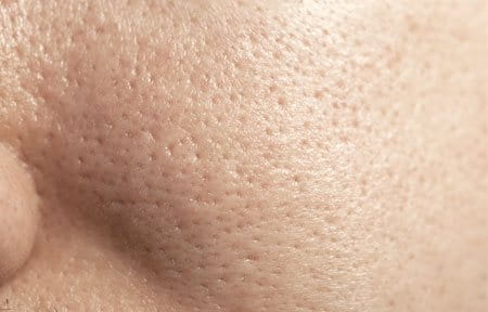 Image result for combination skin close up