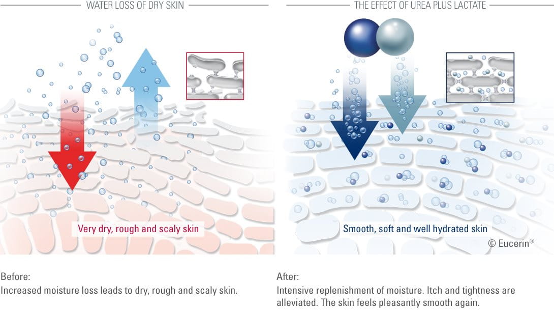 Mode of action of Eucerin Smoothing Night Creme 5% Urea