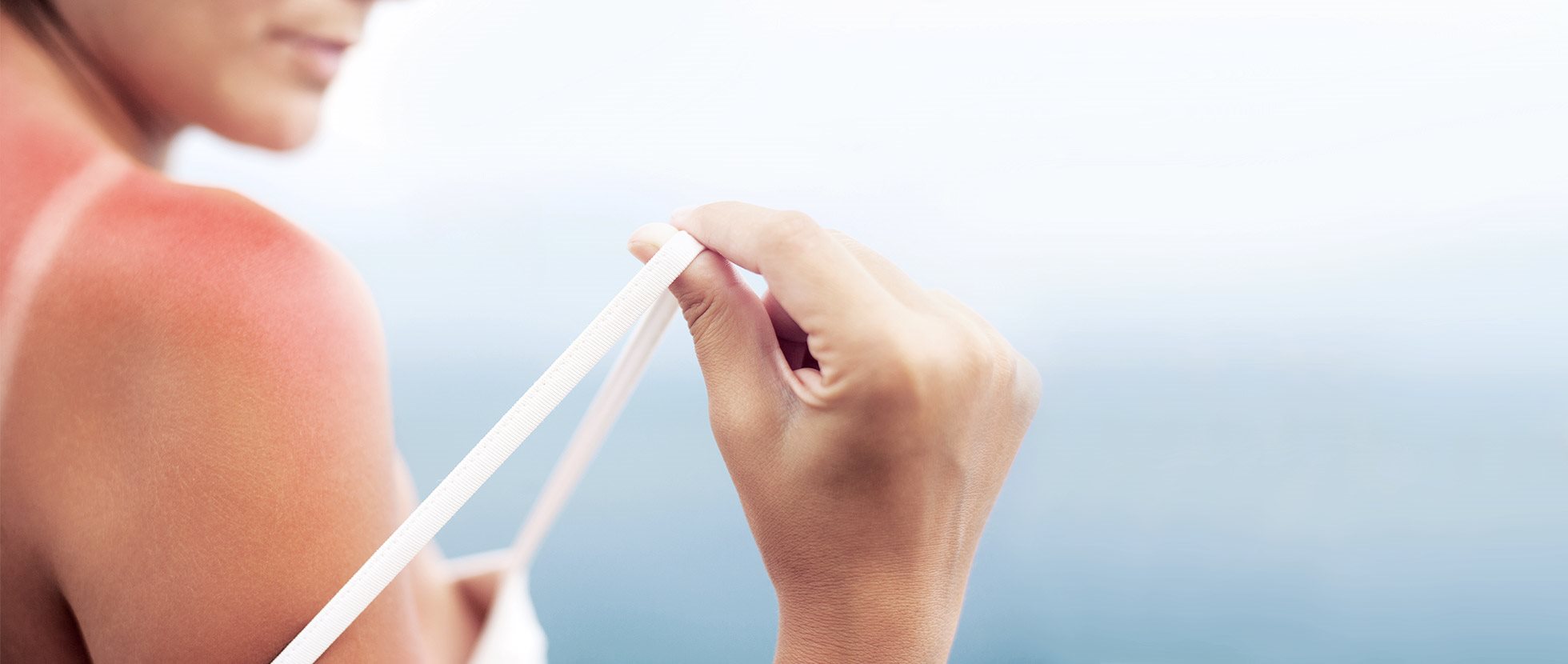 Minor Burns Skin Regeneration Eucerin