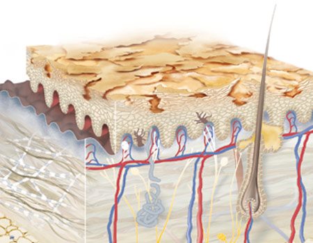 Illustration of dry skin